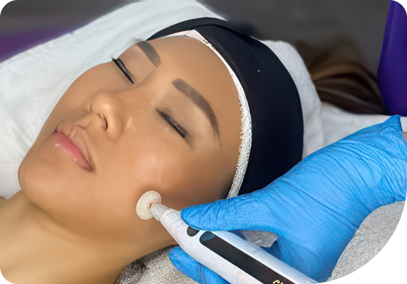 Cold Plasma Therapy being applied during a facial treatment in Orange, CA