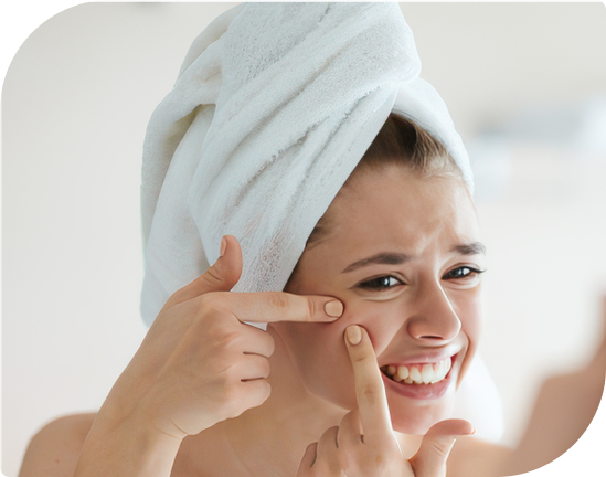 Woman addressing acne concerns, ideal candidate for Acne Facial at Facials & Skincare by Debbie, Orange, CA