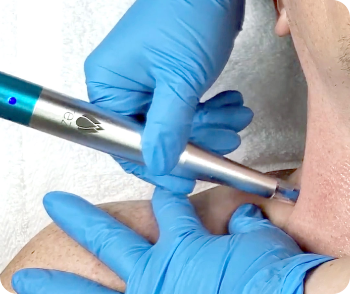 ano-infusion treatment on the neck area, focusing on skin hydration and visible rejuvenation.